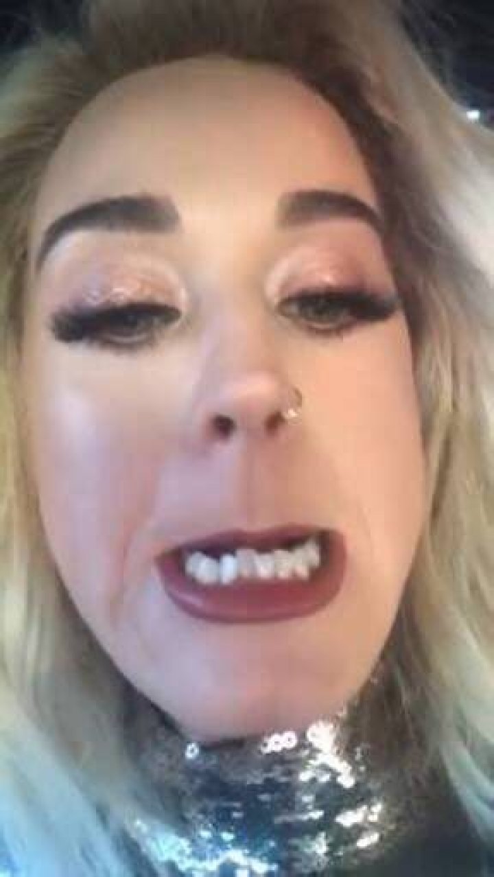 Katy Perry Bottom Teeth